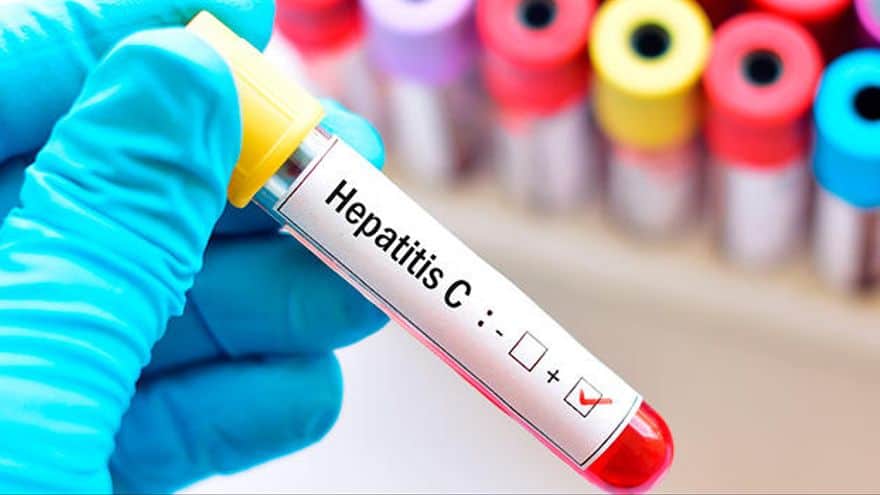 hepatitis c que es