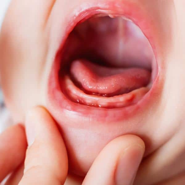 alivia los dientes del bebé